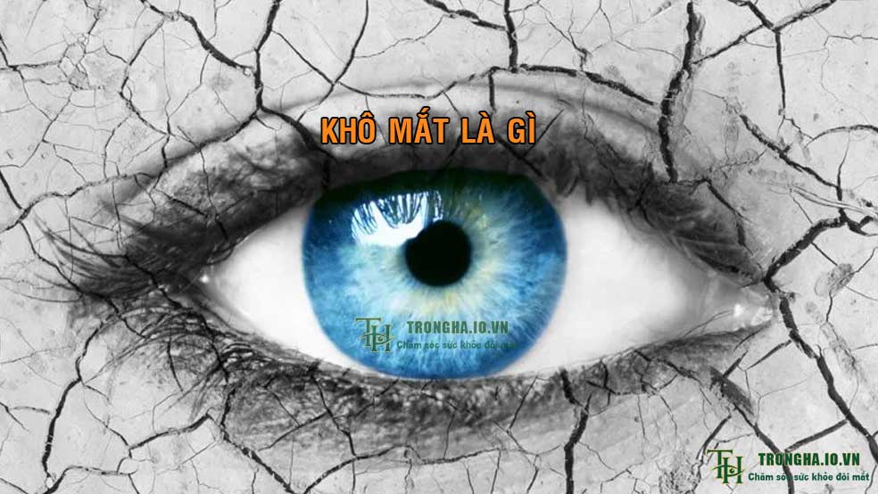 Khô mắt là gì? Dấu hiệu và cách chăm sóc mắt bị khô